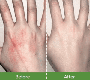 Skin Care 2